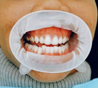 Cosmetic Dentistry