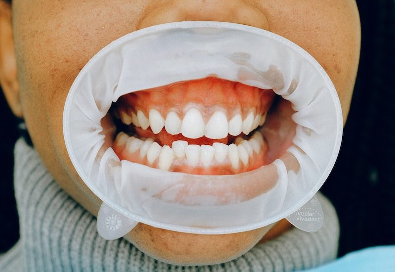 Cosmetic Dentistry